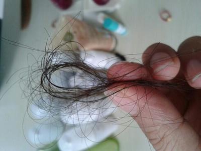 梳洗之扰，发丝何故渐疏？——探析洗浴用品与女性脱发加剧的关联