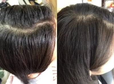从“细软塌”到蓬松高颅顶 一件神器的逆袭